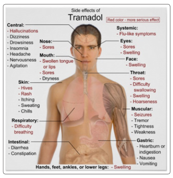 Tramadol & Sports Dr. Sherif Azmy Rizkalla